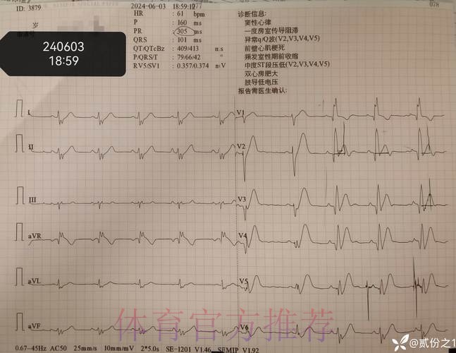 莫德里奇出现发烧症状 经检查已排除新冠感染
